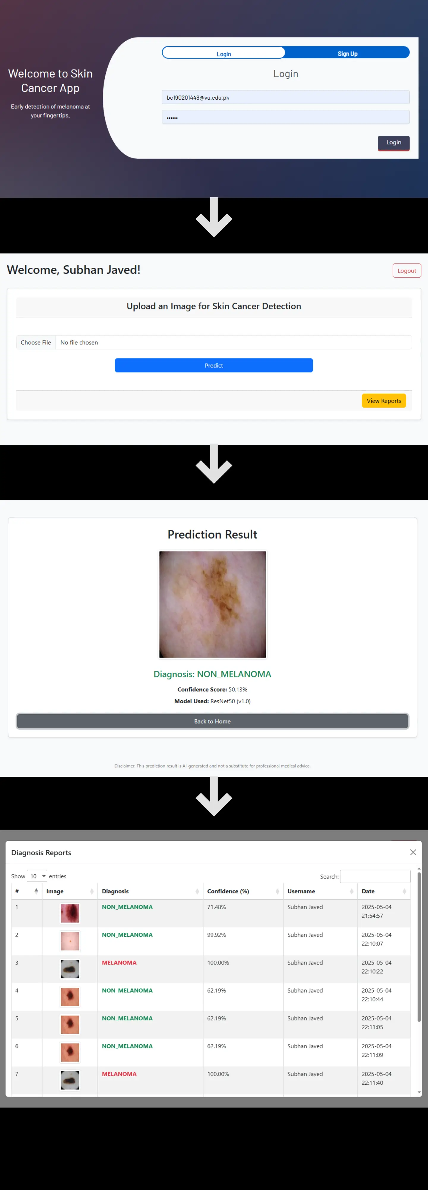 Skin Cancer Detection